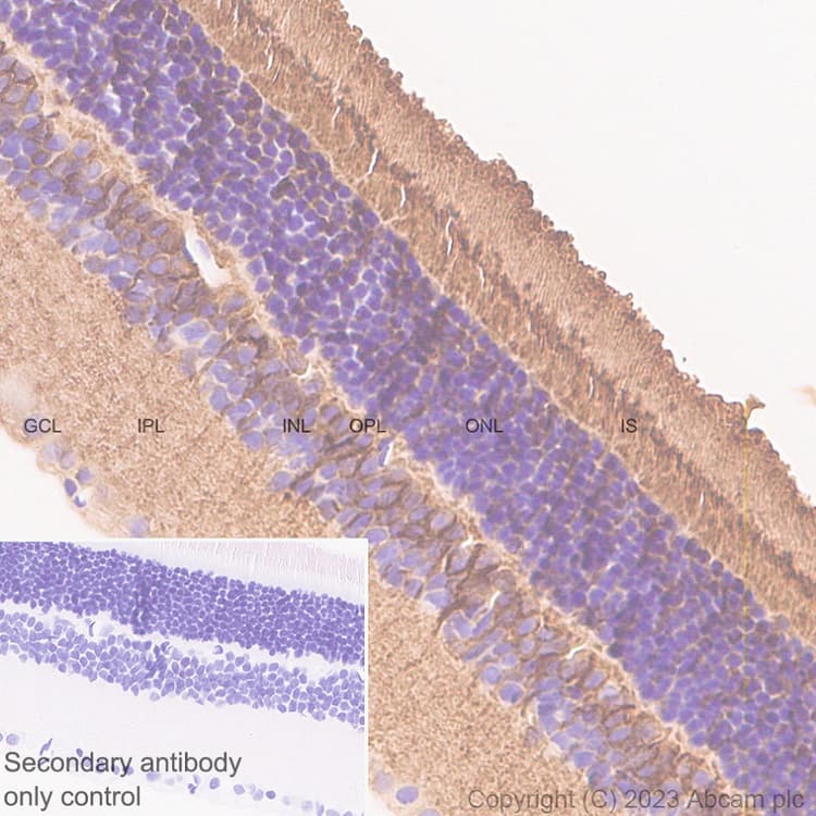 Anti-RS1 antibody [EPR28513-78](AB314231)