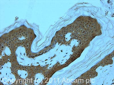 Edc4 Antibody Ab72408  Immunohistochemistry Formalin Pfa Fixed Paraffin Embedded Sections Img114108