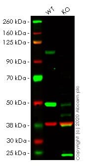 Anti-Sortilin/NT3 antibody [EPR15010] - BSA and Azide free(AB271955)