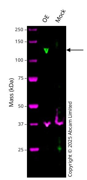 Anti-Telomerase reverse transcriptase antibody [Y182](AB32020)