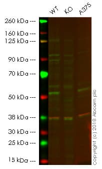 Anti-Retinoic Acid Receptor gamma antibody [EPR2020(N)] - N-terminal(AB187159)