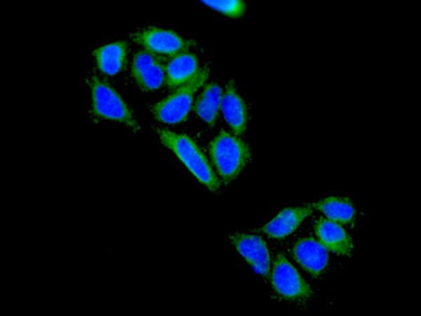 Anti-GGCX antibody [EPR11632] - BSA and Azide free(AB249592)