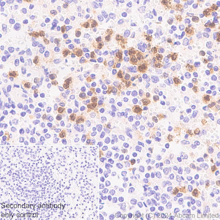 Anti-PADI2 / PAD2 antibody [EPR26940-85](ab322197)