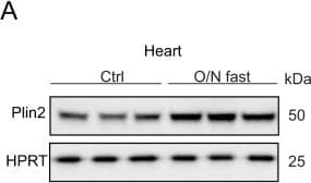 Anti-HPRT antibody [EPR5299](AB109021)