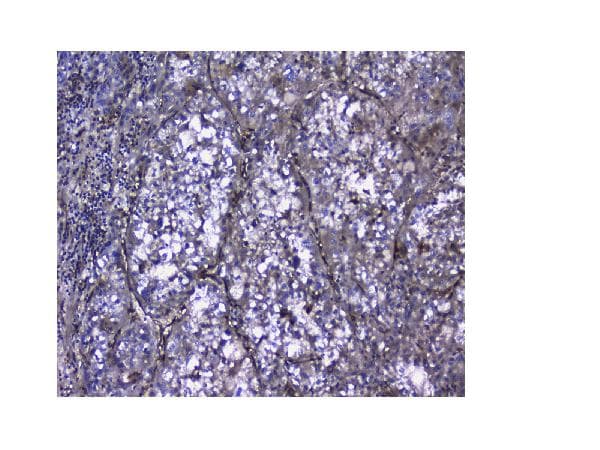 Galectin 1 Antibody Ab112525  Immunohistochemistry Formalin Pfa Fixed Paraffin Embedded Sections Img431298