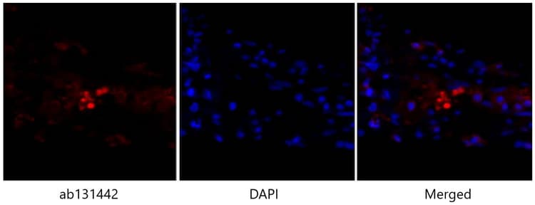 Anti-p53 antibody(AB131442)