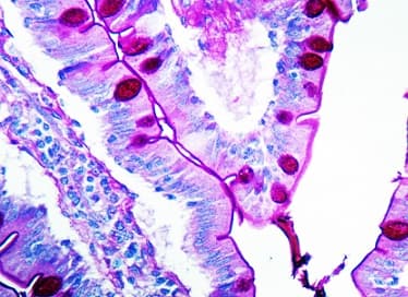 Periodic Acid Schiff (PAS) Stain Kit (Mucin Stain)(AB150680)
