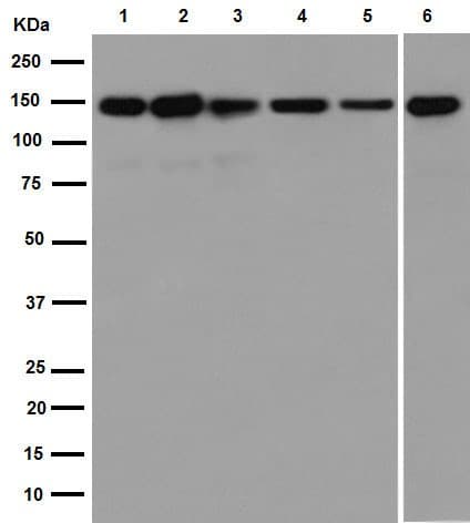 Anti-Collagen VI antibody [EPR17072](AB182744)