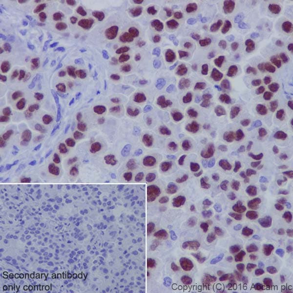 Anti-TTF1/Nkx2-1 antibody [EP1584Y](AB76013)