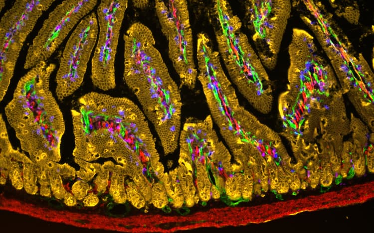 Multiplex IHC Detection kit (TSA amplification)(AB312827)