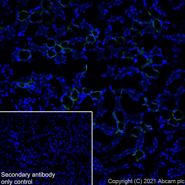 Casr Antibody Epr24050 59 Bsa And Azide Free Ab280360  Immunohistochemistry Frozen Sections Img100465