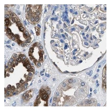 Anti-GST3 / GST pi antibody(AB259373)