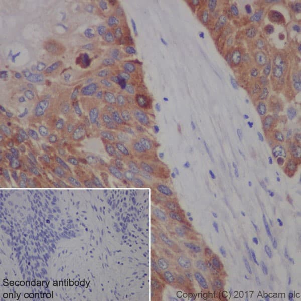 Anti-Transferrin Receptor antibody [EPR20584](AB214039)