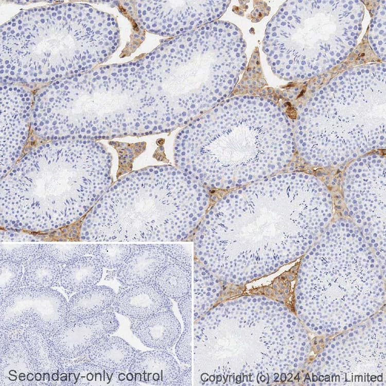 Avidin/Biotin Blocking Kit(ab64212)