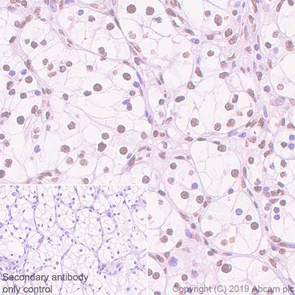 Anti-SMARCA2 / BRM antibody [EPR23103-44] - BSA and Azide free(AB269872)