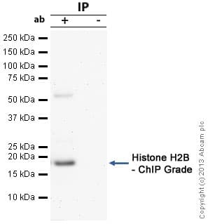 Anti-Histone H2B antibody - ChIP Grade(AB1790)