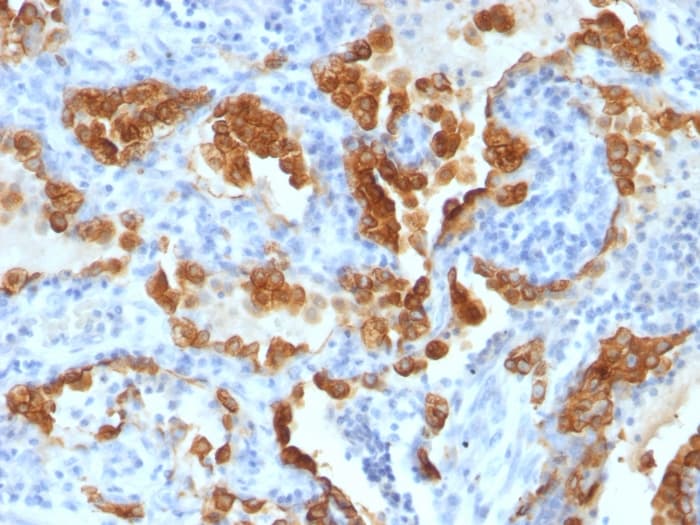 Anti-Cytokeratin 8 antibody [H1-TS1](AB200547)