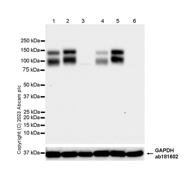 Trkc Antibody Epr22959 404 Ab313761  Western Blot Img418986