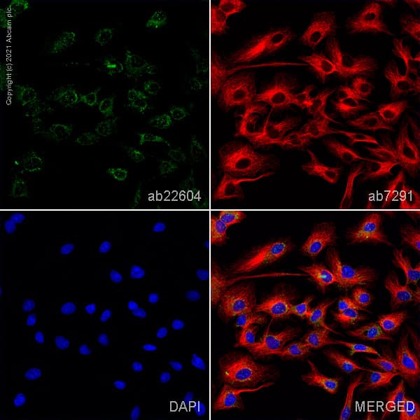 Anti-Glutathione Peroxidase 1 antibody(AB22604)