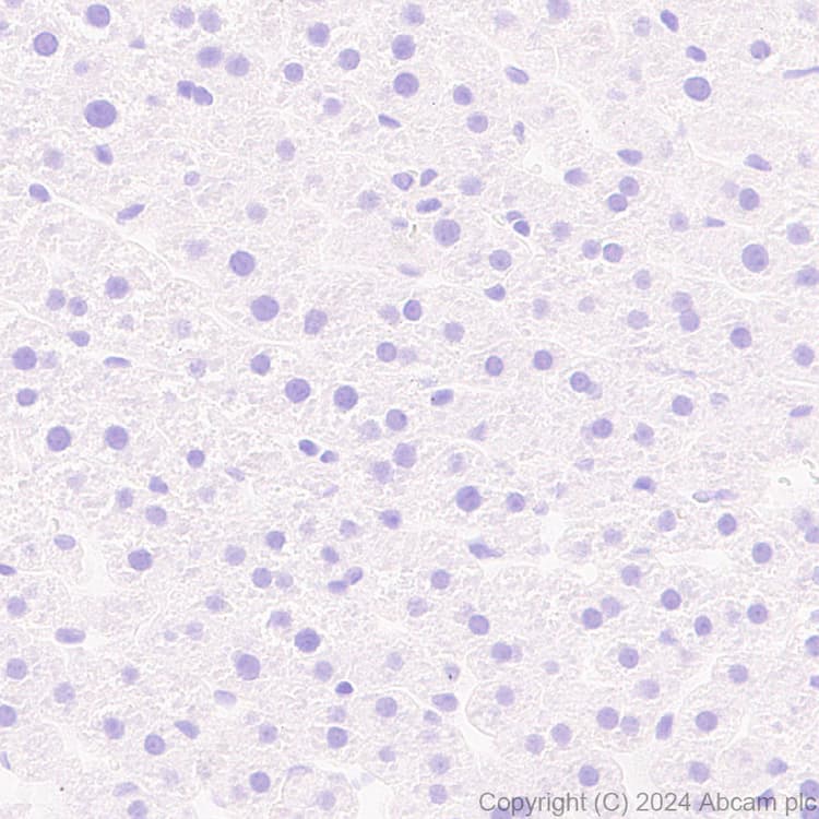Pai1 Antibody Epr21850 262 Bsa And Azide Free Ab317605  Immunohistochemistry Formalin Pfa Fixed Paraffin Embedded Sections Img431904