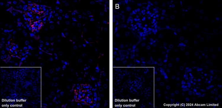 Alexa Fluor 647 Cd38 Antibody Epr21079 Ab320778  Immunohistochemistry Formalin Pfa Fixed Paraffin Embedded Sections Img437314