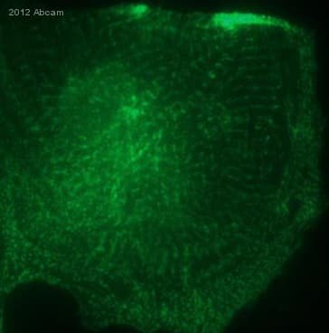 Anti-Cardiac Troponin I antibody(AB47003)