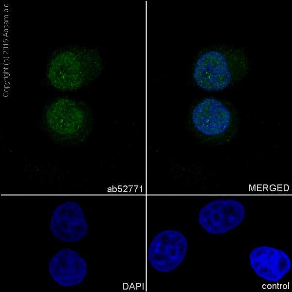 Anti-YAP1 antibody [EP1674Y](AB52771)