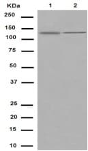 Rbm6 Antibody Epr15842 C Terminal Ab188318  Western Blot Img54480
