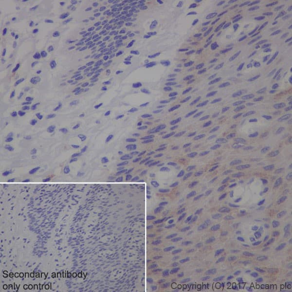 Anti-Transferrin Receptor antibody [EPR20584](AB214039)