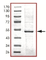 Recombinant Human PRKAR1A protein(AB125532)