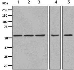 Cap1 Antibody Epr8339b Ab155079  Western Blot Img116858