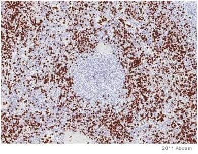 S100a9 Calprotectin S100a8 A9 Complex Antibody Mac387 Ab22506  Immunohistochemistry Formalin Pfa Fixed Paraffin Embedded Sections Img126531