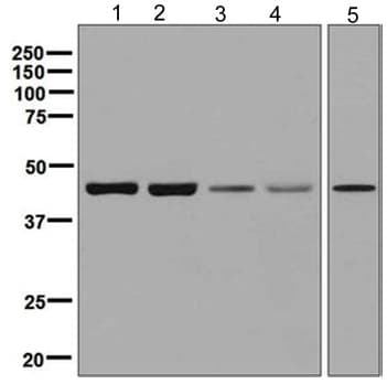 Anti-p39 antibody [EPR5075(2)] - BSA and Azide free(AB248345)