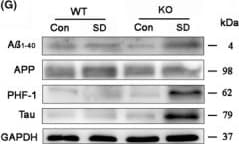 Anti-Tau (phospho S396) antibody [E178](ab32057)