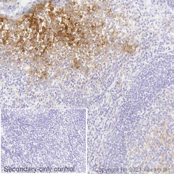 Pd L1 Antibody 28 8 Ab205921 Immunohistochemistry Frozen Sections Img174846