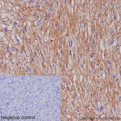 Tmem16a Antibody Epr106432 Bsa And Azide Free Ab251044  Immunohistochemistry Formalin Pfa Fixed Paraffin Embedded Sections Img44393