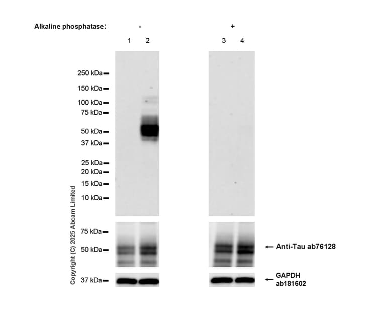 Anti-Tau antibody [EP2456Y](AB76128)