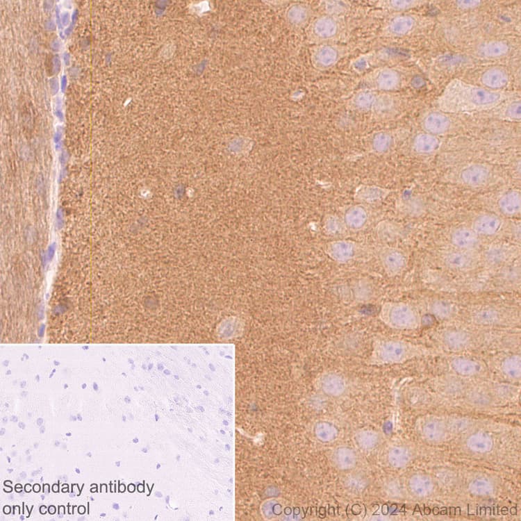Anti-Tau antibody [EP2456Y](AB76128)