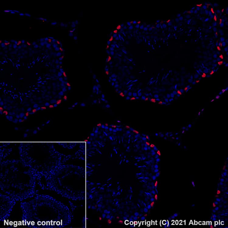 Alexa Fluor® 647 Anti-Wilms Tumor Protein antibody [EPR23963-116](AB283325)