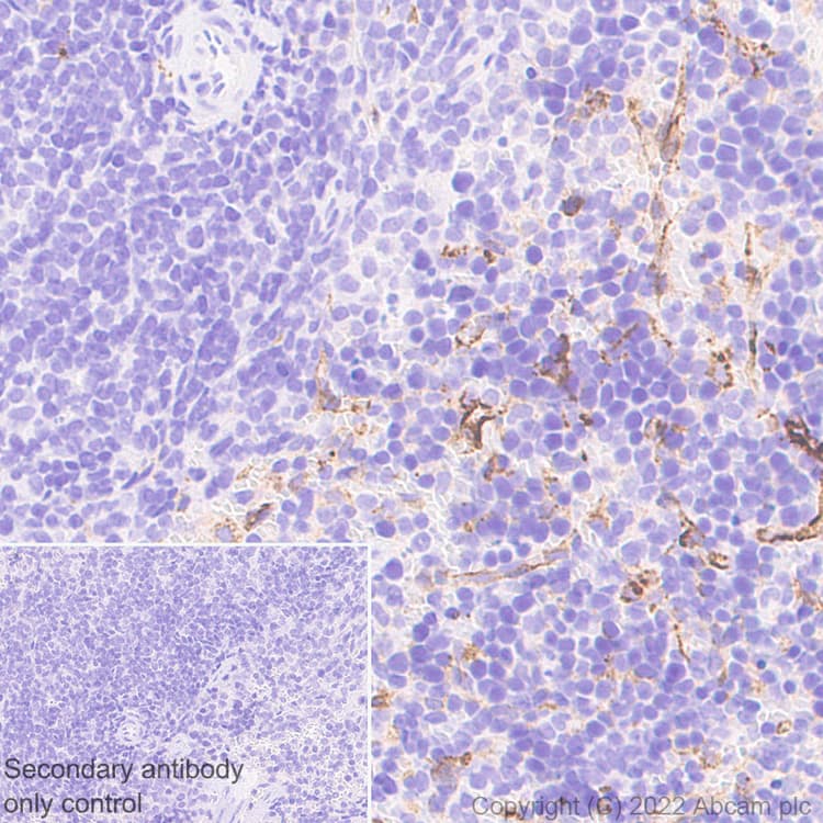 Anti-Mannose Receptor antibody [EPR25215-277](AB300621)