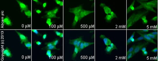 Anti-FMRP antibody(AB17722)