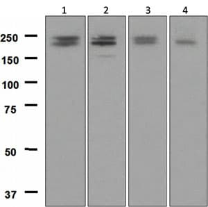 Lrp6 Antibody Epr24232 Ab134146  Western Blot Img30813