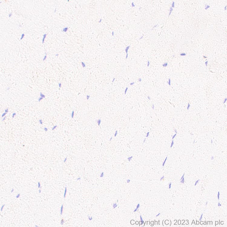 Anti-TMS1/ASC antibody [RM1049](AB309497)