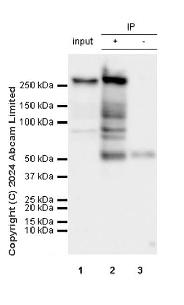 Mtor Antibody Rm1258 Ab322444  Immunoprecipitation Img438204