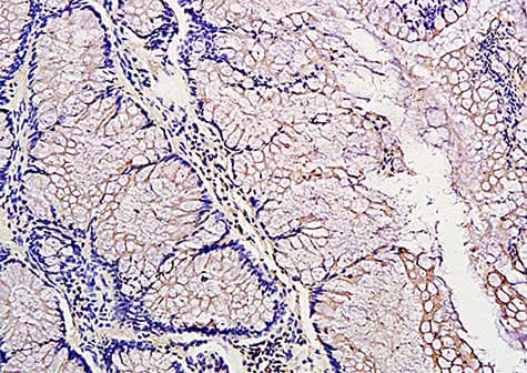 Anti-PDGF AA antibody(AB216619)
