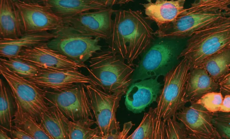 ImageXpress® Nano Automated Imaging System