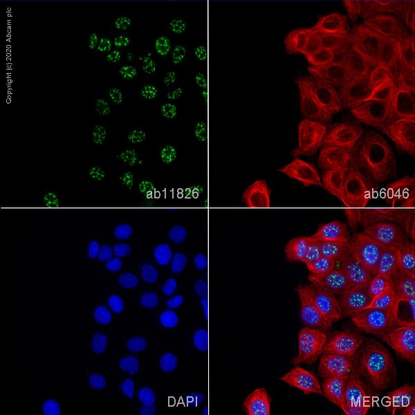 Anti-SC35 antibody [SC-35] - Nuclear Speckle Marker(AB11826)