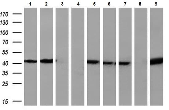 Anti-SIRT6 antibody [OTI1G3](AB119007)