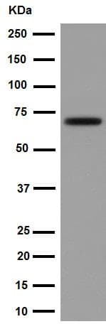 Anti-Choline Acetyltransferase antibody [EPR16590](AB178850)