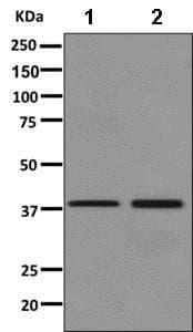 Anti-Fbx32 antibody [EPR9148(2)](AB168372)